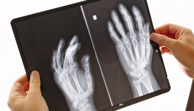 病院でレントゲンを撮ったが異常なしと言われた